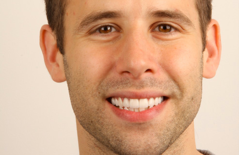 Crooked Or Sloping Teeth